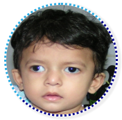 Little Boy Squint and Pediatric Ophthalmology